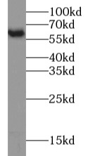 PKM2-specific antibody|PKM2抗体 