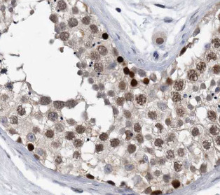 TRIP13 antibody|TRIP13抗体