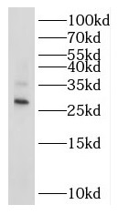 RPL7L1 antibody|RPL7L1抗体