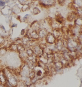 IL4R antibody|IL4R抗体