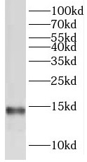 TMEM50B antibody|TMEM50B抗体