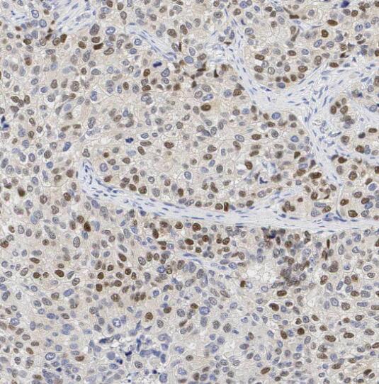 SF3A1 antibody|SF3A1抗体