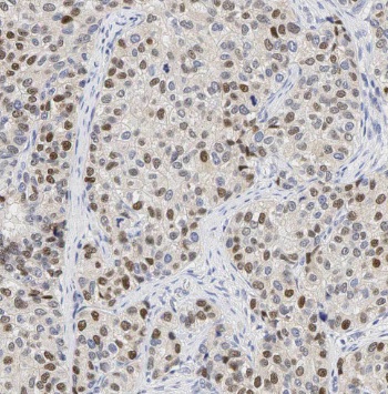 TAF9B antibody|TAF9B抗体