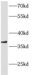 ANKRD1 antibody|ANKRD1抗体