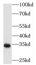 PECR antibody|PECR抗体