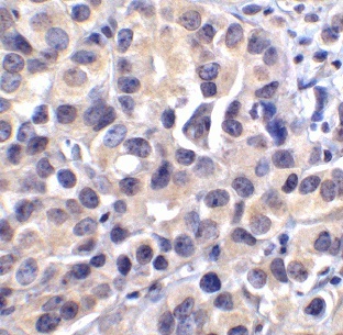 BCAT1 antibody|BCAT1抗体