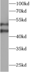 WARS1 antibody|WARS1抗体 FNab100