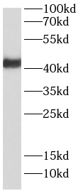 RNF34 antibody|RNF34抗体 FNab101