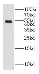 GAL3ST3 antibody|GAL3ST3抗体
