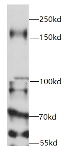 USP19 antibody|USP19抗体