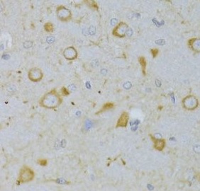 TSHR antibody|TSHR抗体