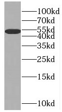 SLC25A25 antibody|SLC25A25抗体