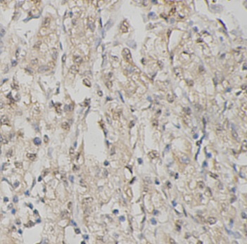 SIRT6 antibody|SIRT6抗体 FNab102
