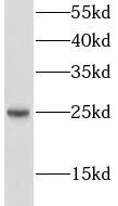 LIN7C antibody|LIN7C抗体