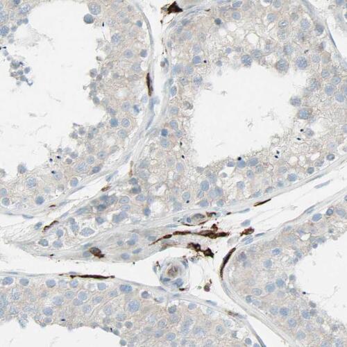 PGM1 antibody|PGM1抗体 FNab06359