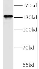 PPP6R3 antibody|PPP6R3抗体