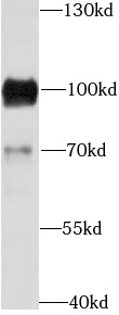 CD19 antibody|CD19抗体