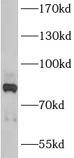 ANKZF1 antibody|ANKZF1抗体