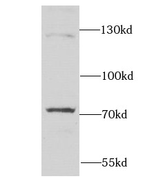 DARS2 antibody|DARS2抗体