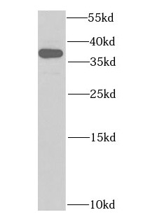 HDGF antibody|HDGF抗体 FNab03808