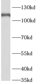 RBL1 antibody|RBL1抗体