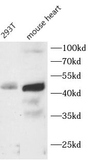 CFHR3 antibody|CFHR3抗体 FNab107