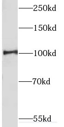 CUL4B antibody|CUL4B抗体 FNab020