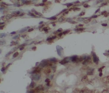 HDAC2 antibody|HDAC2抗体 FNab099