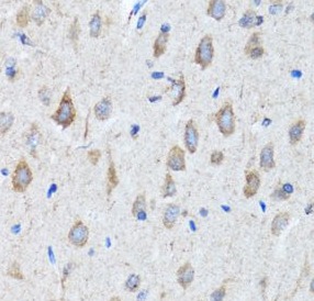 CHAT antibody|CHAT抗体 FNab01631