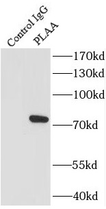 PBX1 antibody|PBX1抗体