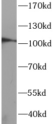 DDR1 antibody|DDR1抗体 FNab10051
