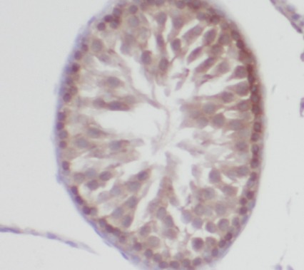 MSRB3 antibody|MSRB3抗体