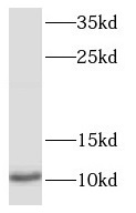 S100P antibody|S100P抗体