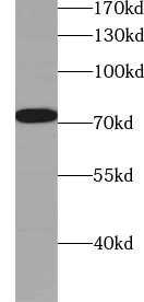ZXDC antibody|ZXDC抗体