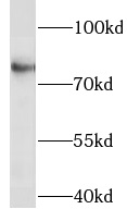 LINGO1 antibody|LINGO1抗体