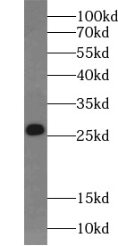 V5-tag antibody|V5-tag抗体