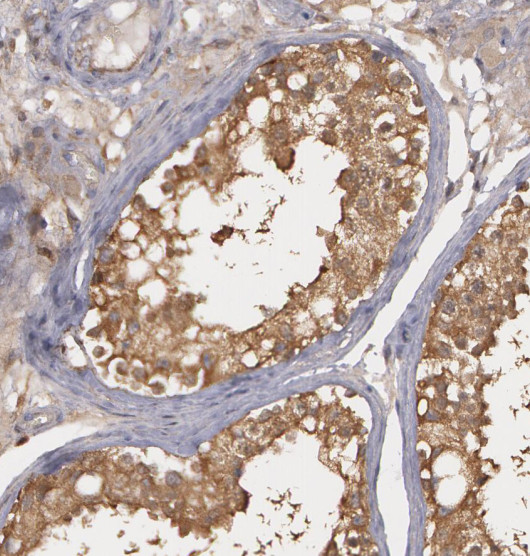 RNF8 antibody|RNF8抗体
