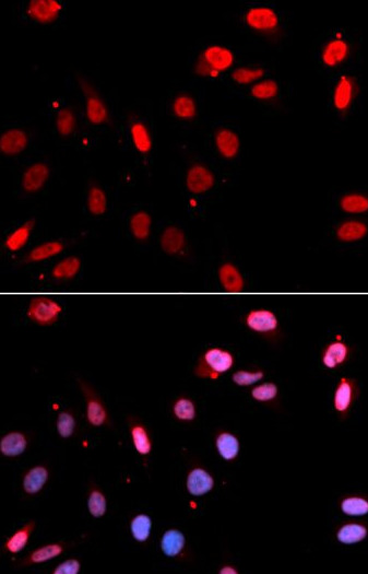 RAD18 antibody|RAD18抗体