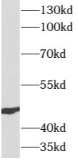 ATG12 antibody|ATG12抗体 FNab006