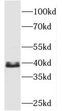 TBCC antibody|TBCC抗体