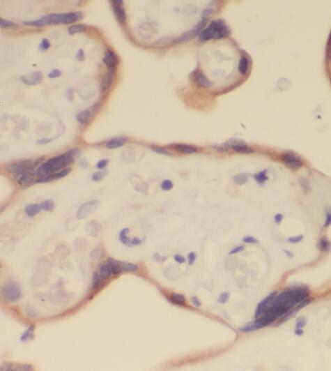 PTPN14 antibody|PTPN14抗体