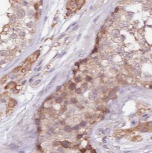 ALDH1B1 antibody|ALDH1B1抗体 FNa