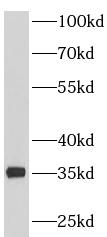 PDHB antibody|PDHB抗体