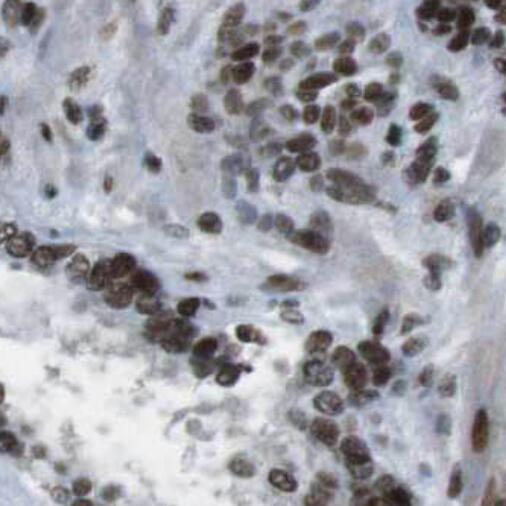 SRSF7 antibody|SRSF7抗体