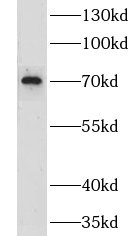 LRCH3 antibody|LRCH3抗体