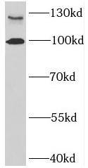 BMPR2 antibody|BMPR2抗体 FNab009