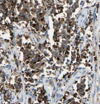 BACH1 antibody|BACH1抗体