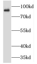 TMCC2 antibody|TMCC2抗体