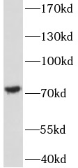 FOXO6 antibody|FOXO6抗体 FNab032