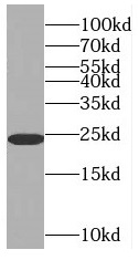 RAB6A antibody|RAB6A抗体